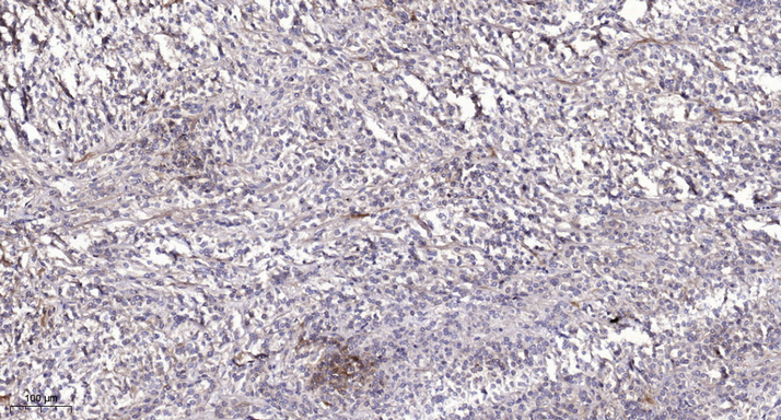 2 - PTPRQ Rabbit Polyclonal Antibody AP93563
