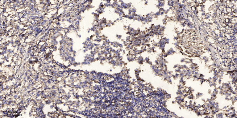 2 - PT117 Rabbit Polyclonal Antibody AP93576