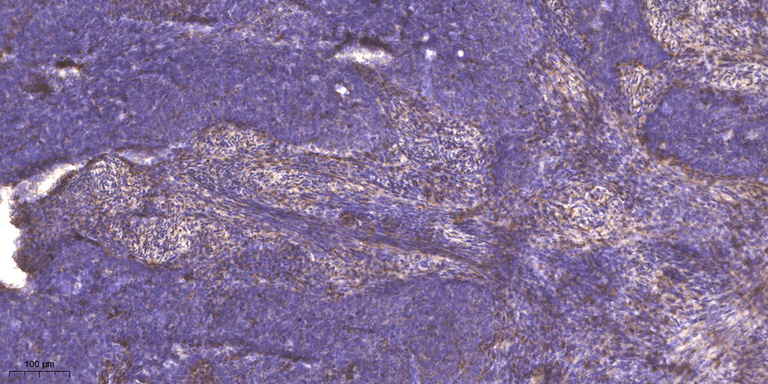 2 - MYH-pan (Acetyl Lys1394) Rabbit Polyclonal Antibody AP93577