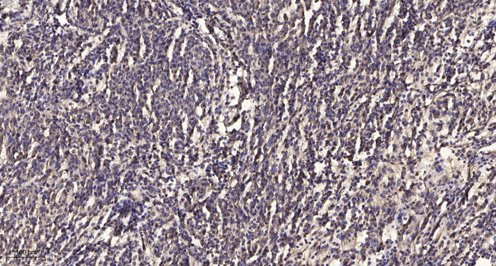 2 - MYH-pan (Acetyl Lys505) Rabbit Polyclonal Antibody AP93578