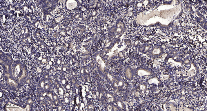 2 - Smad2/3 (Acetyl Lys420/378) Rabbit Polyclonal Antibody AP93579