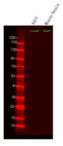 1 - ASH1L Rabbit Polyclonal Antibody AP93580