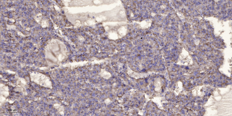 2 - LC3 A/B Rabbit Polyclonal Antibody AP93585