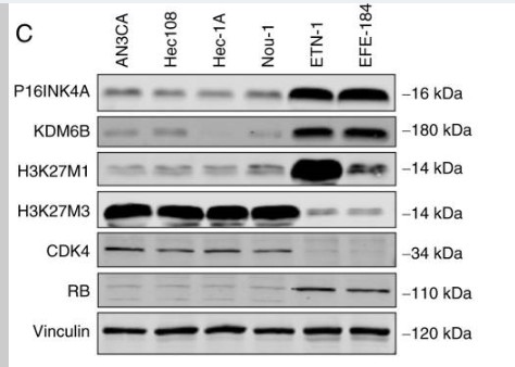 1 - Histone H3 (Tri Methyl Lys27) Rabbit Polyclonal Antibody AP93612