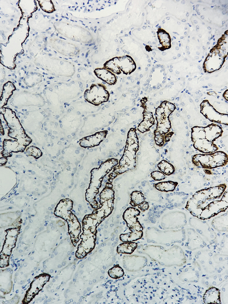 1 - Sodium Potassium ATPase (PTR2543) Mouse Monoclonal Antibody AP93709