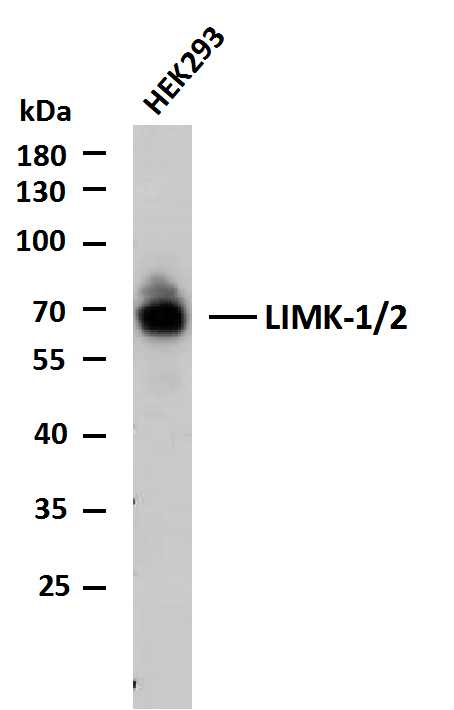1 - LIMK-1/2 (PTR2545) Mouse Monoclonal Antibody AP93710