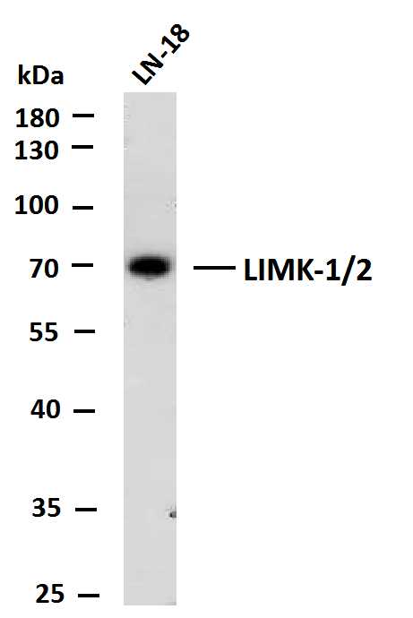 1 - LIMK-1/2 (PTR2545) Mouse Monoclonal Antibody AP93710