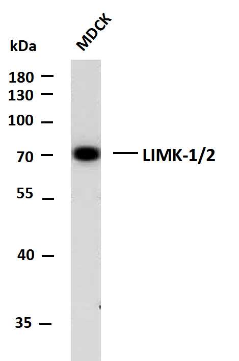 1 - LIMK-1/2 (PTR2545) Mouse Monoclonal Antibody AP93710