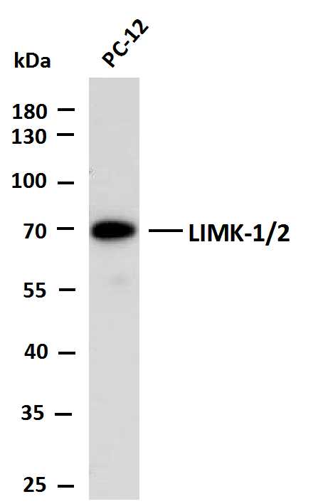 1 - LIMK-1/2 (PTR2545) Mouse Monoclonal Antibody AP93710