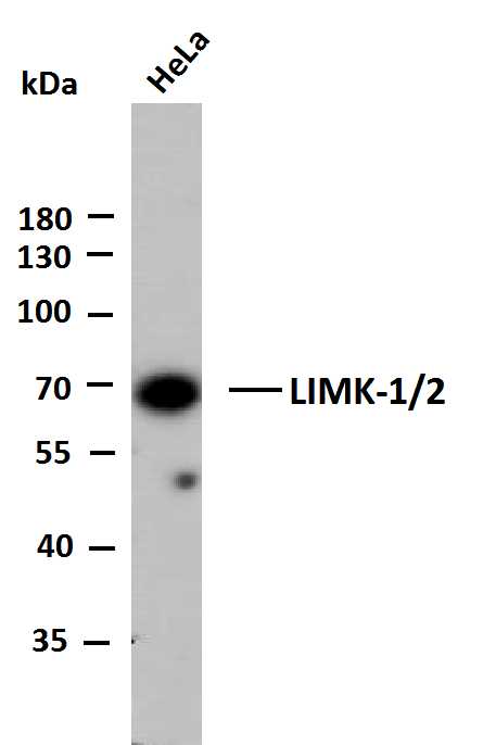 1 - LIMK-1/2 (PTR2545) Mouse Monoclonal Antibody AP93710