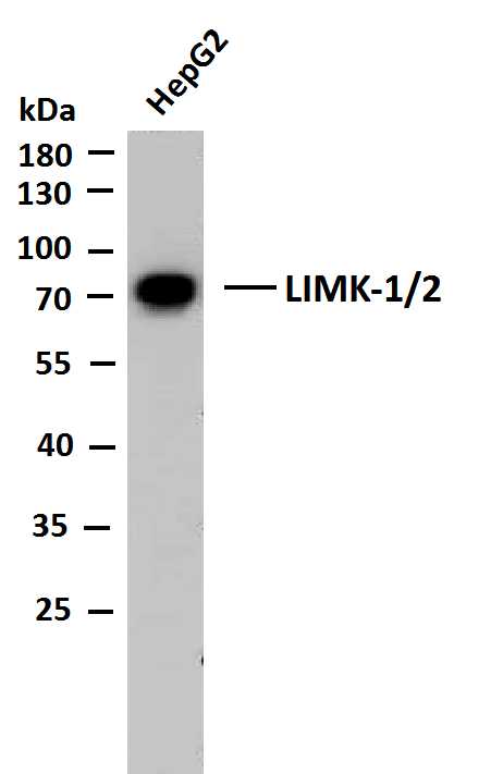 1 - LIMK-1/2 (PTR2545) Mouse Monoclonal Antibody AP93710