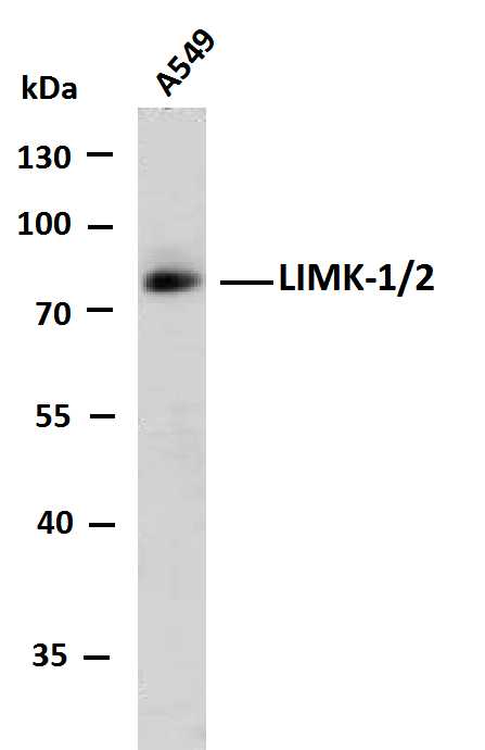 1 - LIMK-1/2 (PTR2545) Mouse Monoclonal Antibody AP93710