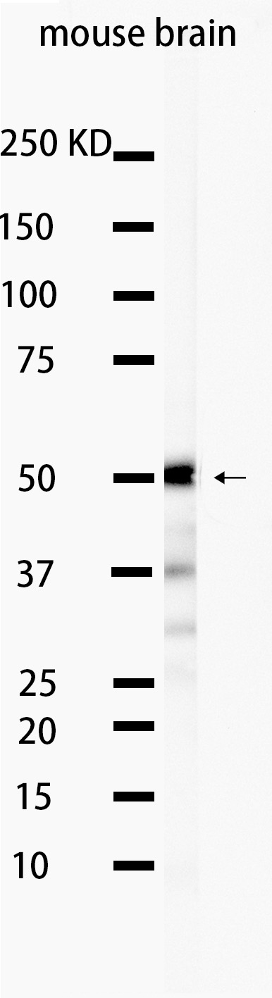 1 - Tau 4R (16R8) Rabbit Monoclonal Antibody AP93714