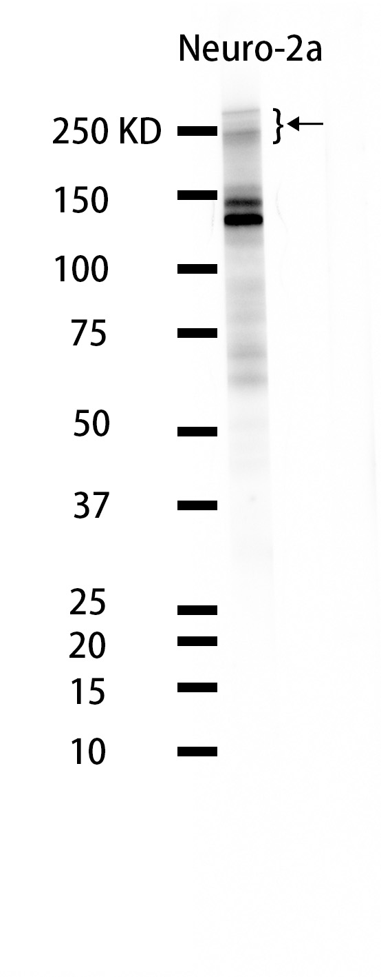 1 - Nestin (7M5) Rabbit Monoclonal Antibody AP93715