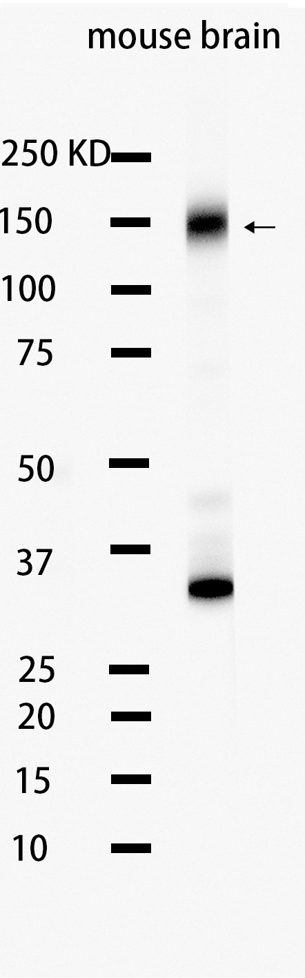 1 - Trk (pan)  (17J17) Rabbit Monoclonal Antibody AP93716