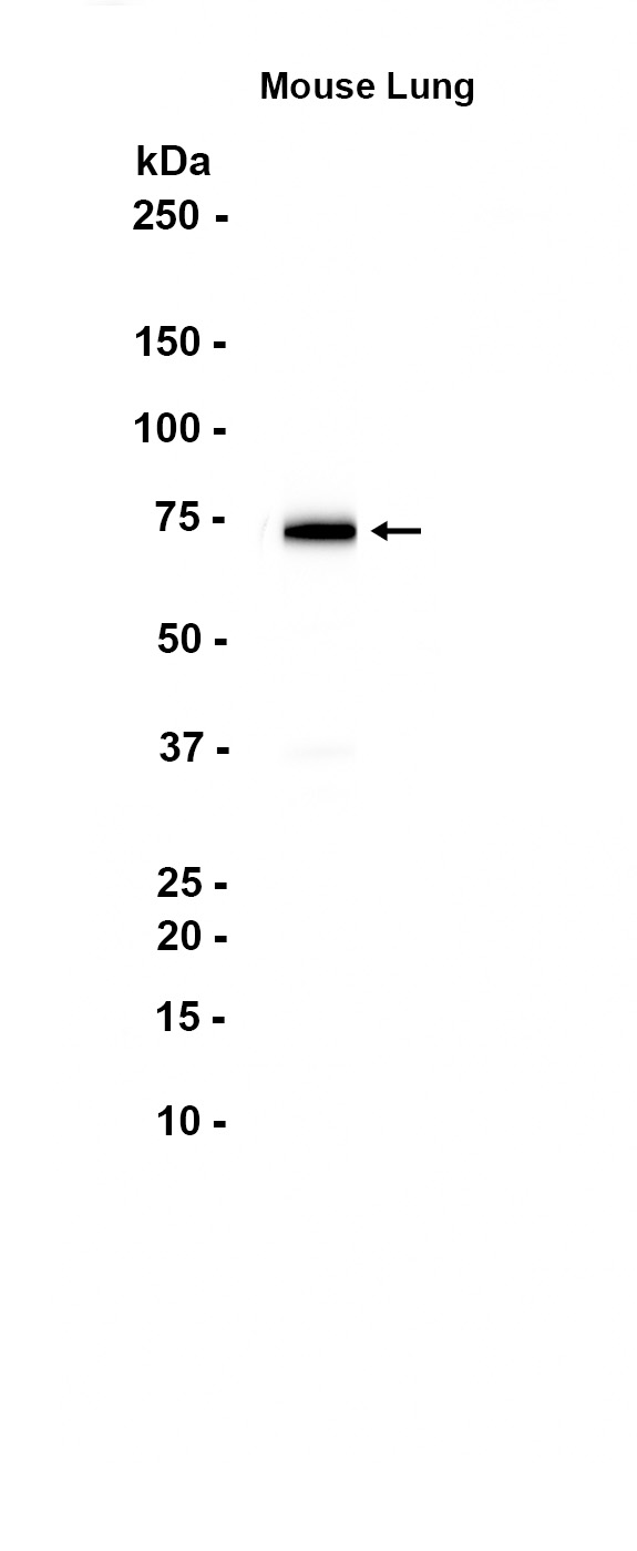 1 - ALOX15 (19A1) Rabbit Monoclonal Antibody AP93717