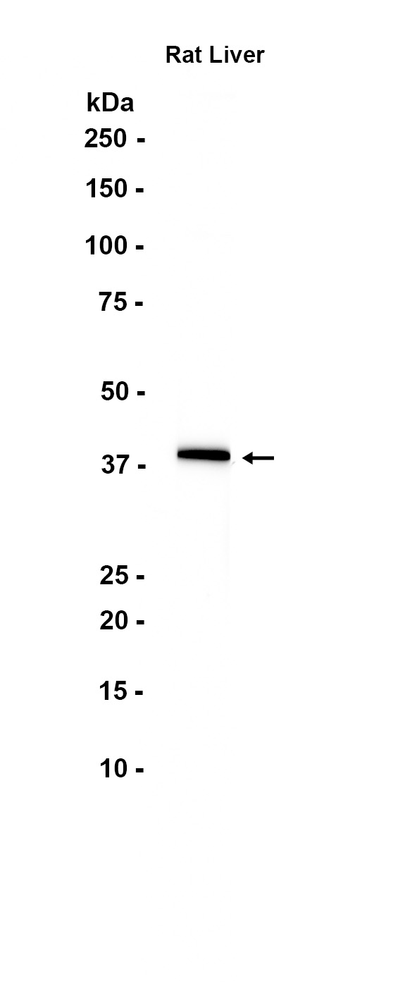1 - AGXT (4O10) Rabbit Monoclonal Antibody AP93720