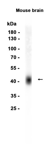 1 - ATP1B2 (13K18) Rabbit Monoclonal Antibody AP93726