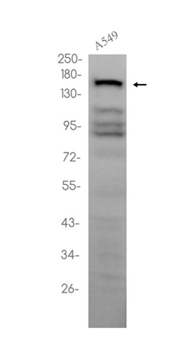 1 - SMARCC2/BAF170 (11S2) Rabbit Monoclonal Antibody AP93727