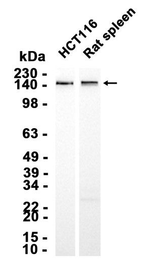 1 - SMARCC2/BAF170 (11S2) Rabbit Monoclonal Antibody AP93727