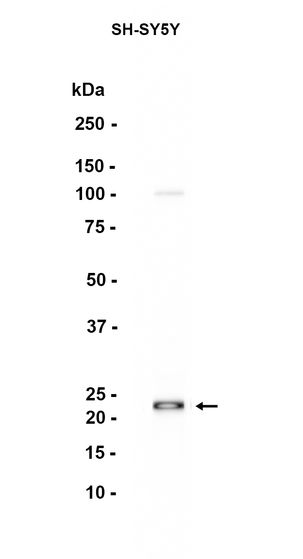 1 - BTG1 (5V7) Rabbit Monoclonal Antibody AP93732