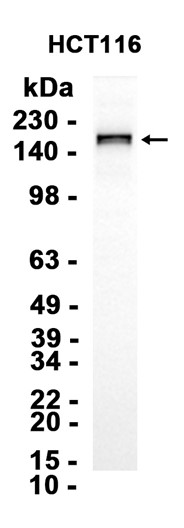 1 - DEPDC5 (3L15) Rabbit Monoclonal Antibody AP93735