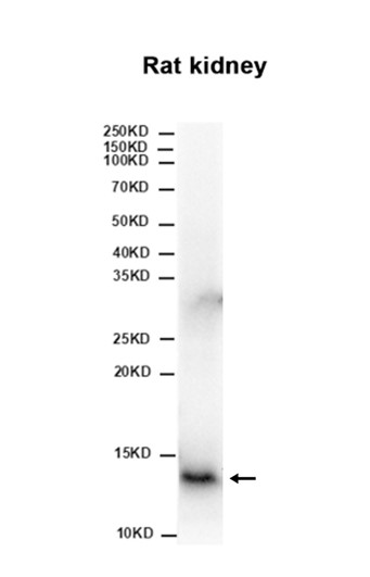 1 - FXN (11J13) Rabbit Monoclonal Antibody AP93739