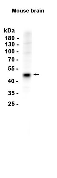 1 - GIRK2 (3K8) Rabbit Monoclonal Antibody AP93741