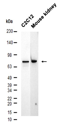 1 - HNF1A (11Z13) Rabbit Monoclonal Antibody AP93744