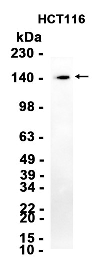 1 - KDM3A (8K18) Rabbit Monoclonal Antibody AP93745