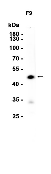 1 - Oct6 (4B17) Rabbit Monoclonal Antibody AP93747