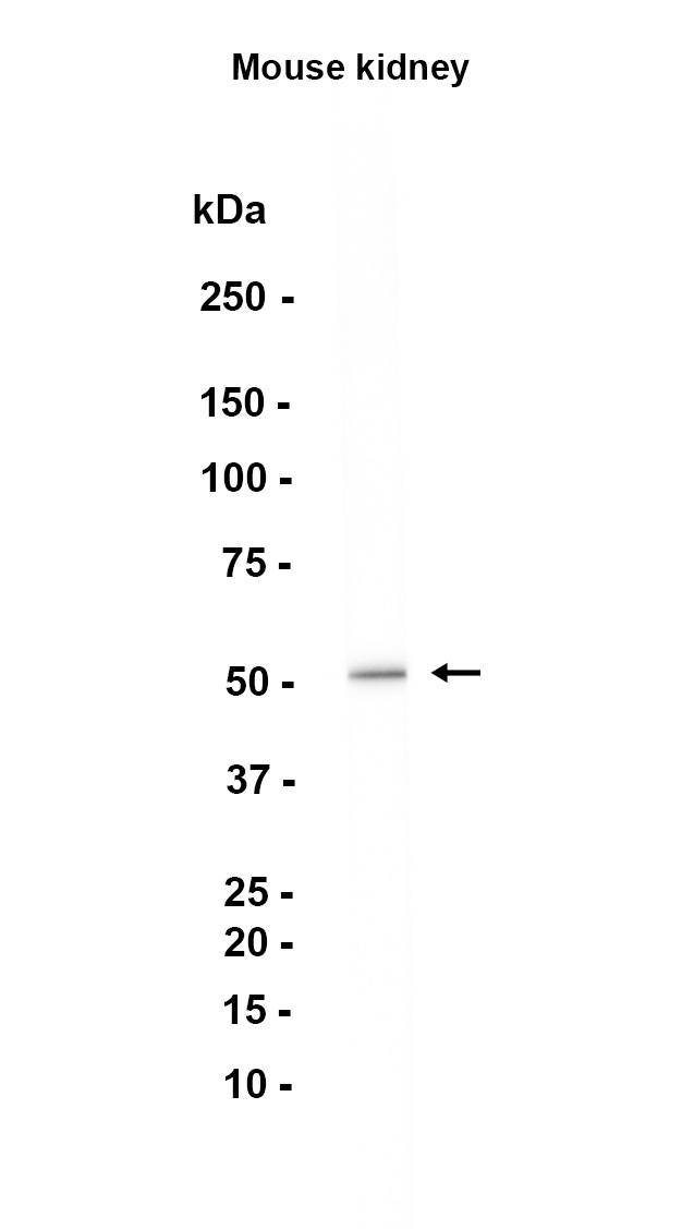 1 - Acetyl-p53 (Lys305) (10F14) Rabbit Monoclonal Antibody AP93748