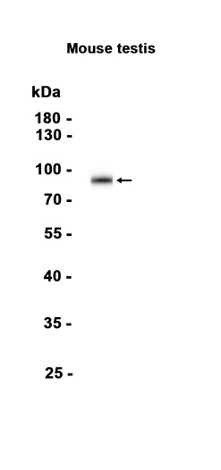 1 - PDE10A (8E18) Rabbit Monoclonal Antibody AP93751