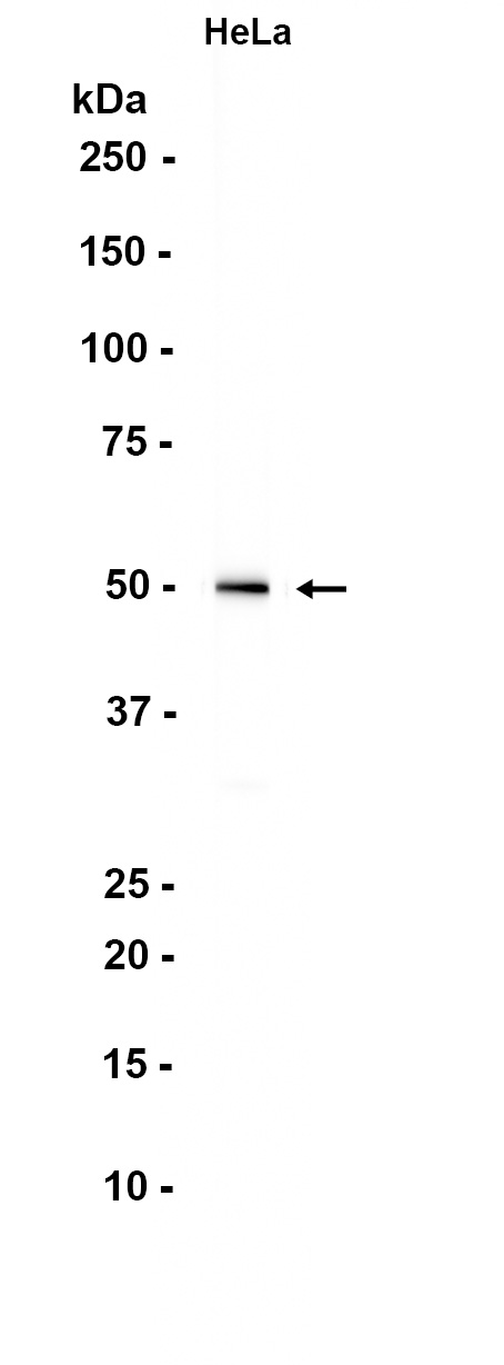 1 - PIGU (11T18) Rabbit Monoclonal Antibody AP93753