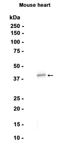 1 - PON2 (12A8) Rabbit Monoclonal Antibody AP93755