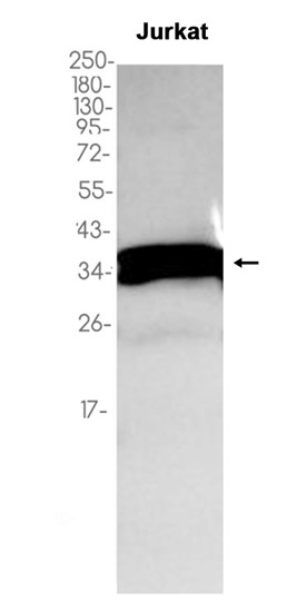 1 - PPP2CA/B (7Z19) Rabbit Monoclonal Antibody AP93756