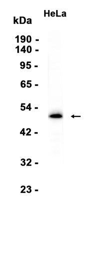1 - PTPN1 (13Q3) Rabbit Monoclonal Antibody AP93757