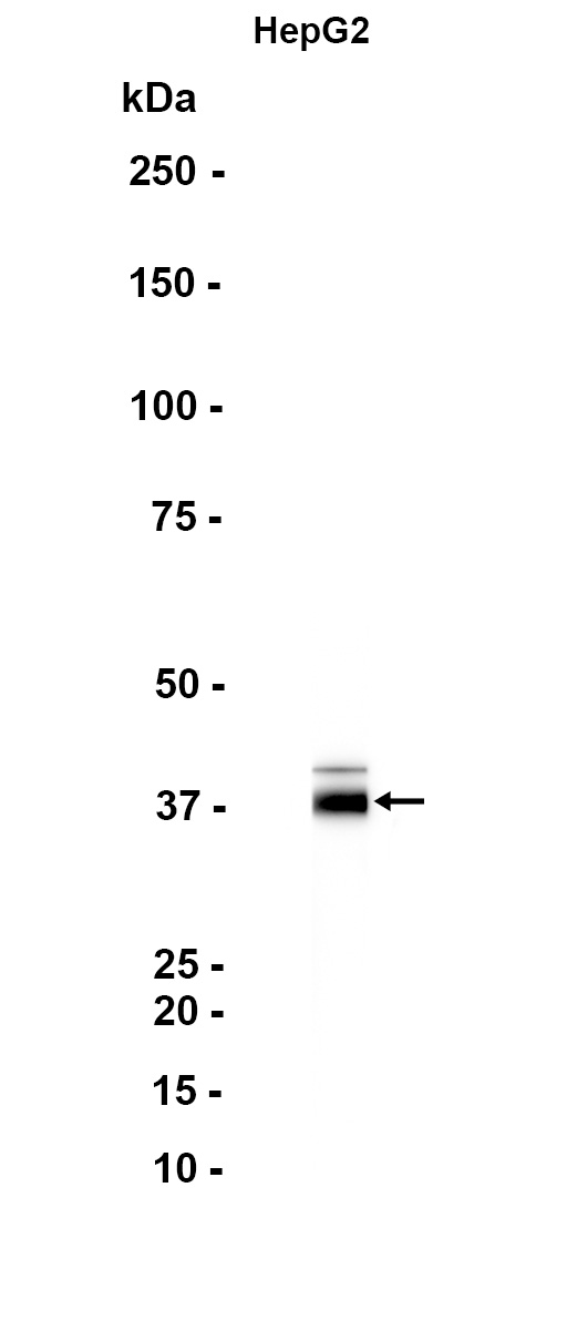 1 - RNF2 (5R15) Rabbit Monoclonal Antibody AP93760