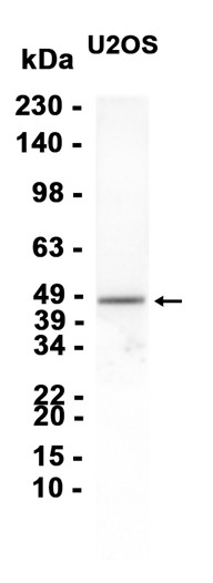 1 - SERPINB3/4 (3Z7) Rabbit Monoclonal Antibody AP93762