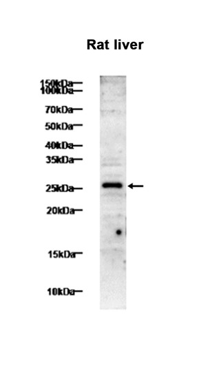 1 - TNF alpha (8B2) Rabbit Monoclonal Antibody AP93769