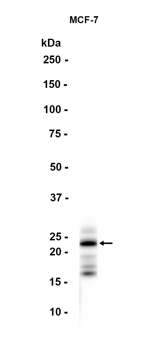 1 - TPD52 (14S6) Rabbit Monoclonal Antibody AP93770