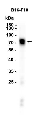 1 - TYRP1 (7O11) Rabbit Monoclonal Antibody AP93772