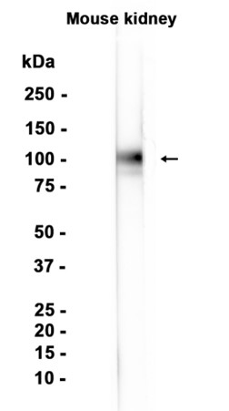 1 - Uromodulin (13X1) Rabbit Monoclonal Antibody AP93775