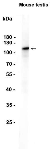 1 - USP16 (18S13) Rabbit Monoclonal Antibody AP93776