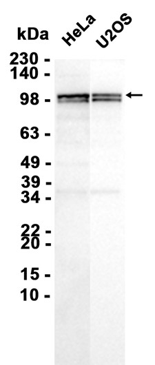 1 - YTHDC1 (6W12) Rabbit Monoclonal Antibody AP93778