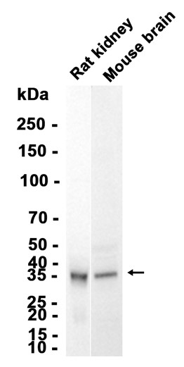 1 - Frzb (10J17) Rabbit Monoclonal Antibody AP93781