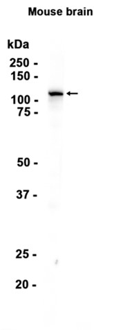 1 - DHX36 (9T10) Rabbit Monoclonal Antibody AP93782