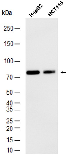 1 - Androgen Receptor(AR-V7 specific) (6K19) Rabbit Monoclonal Antibody AP93784