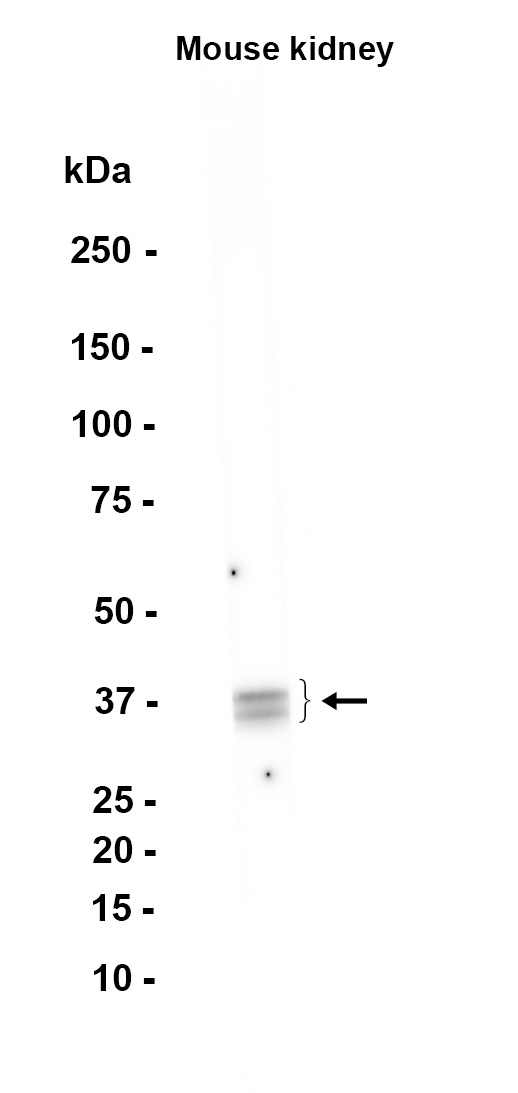 1 - Cytokeratin 19 (8Q2) Rabbit Monoclonal Antibody AP93785