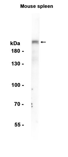 1 - Integrin beta 4 (14U18) Rabbit Monoclonal Antibody AP93787